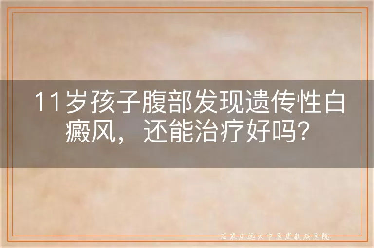 11岁孩子腹部发现遗传性白癜风，还能治疗好吗？