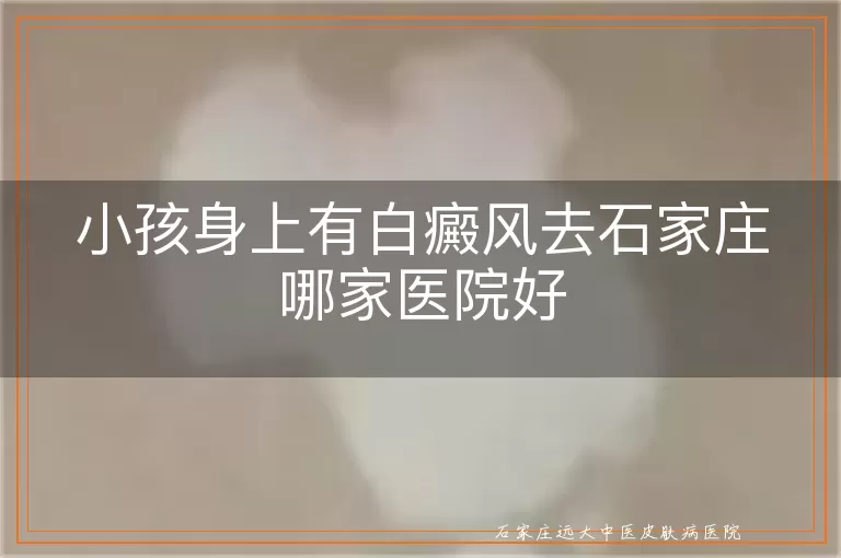 小孩身上有白癜风去石家庄哪家医院好
