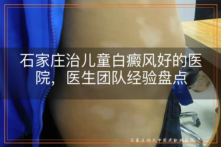 石家庄治儿童白癜风好的医院，医生团队经验盘点