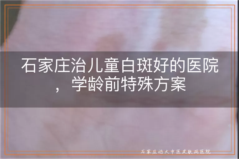 石家庄治儿童白斑好的医院，学龄前特殊方案