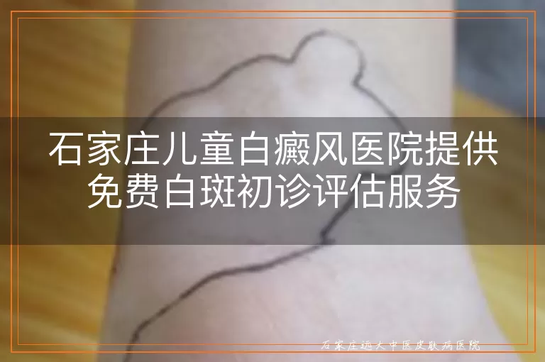 石家庄儿童白癜风医院提供免费白斑初诊评估服务