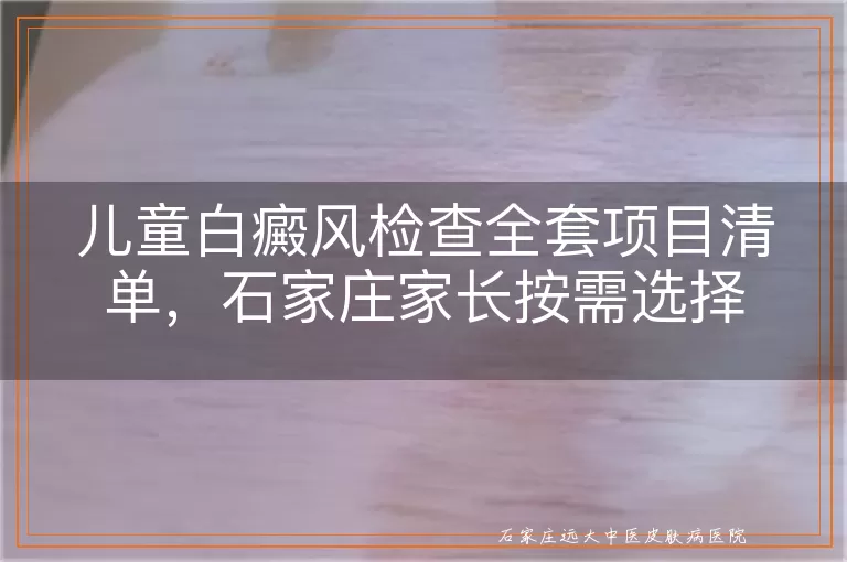 儿童白癜风检查全套项目清单，石家庄家长按需选择