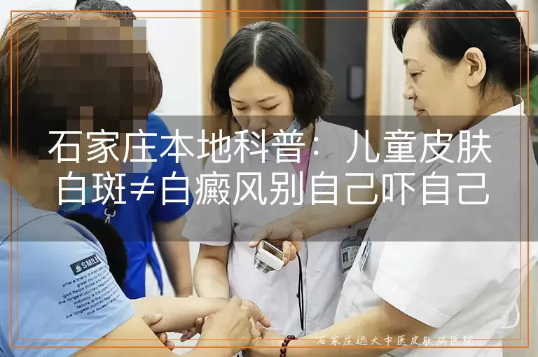 石家庄本地科普:儿童皮肤白斑≠白癜风别自己吓自己