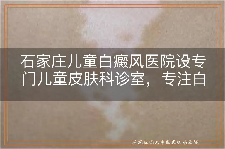 石家庄儿童白癜风医院设专门儿童皮肤科诊室，专注白癜风白斑诊疗