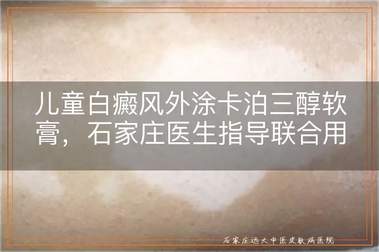 儿童白癜风外涂卡泊三醇软膏，石家庄医生指导联合用法