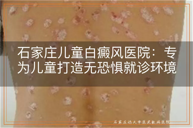 石家庄儿童白癜风医院:专为儿童打造无恐惧就诊环境