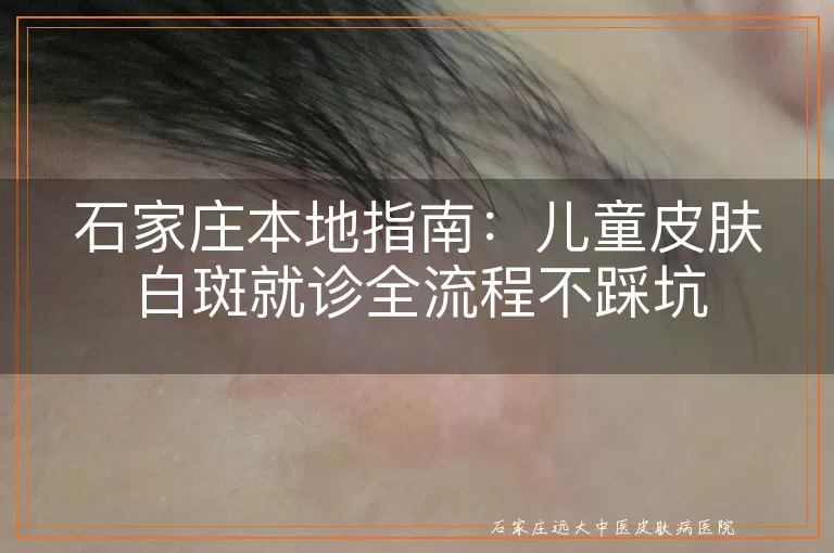 石家庄本地指南：儿童皮肤白斑就诊全流程不踩坑