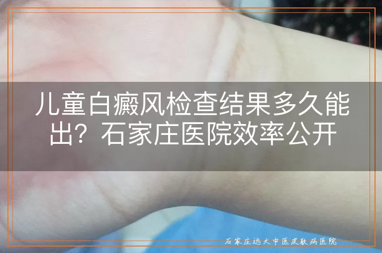 儿童白癜风检查结果多久能出？石家庄医院效率公开