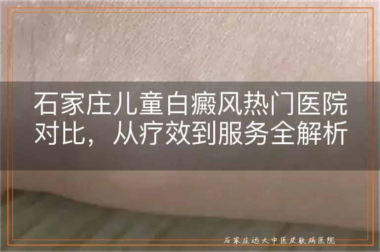 石家庄儿童白癜风热门医院对比，从疗效到服务全解析