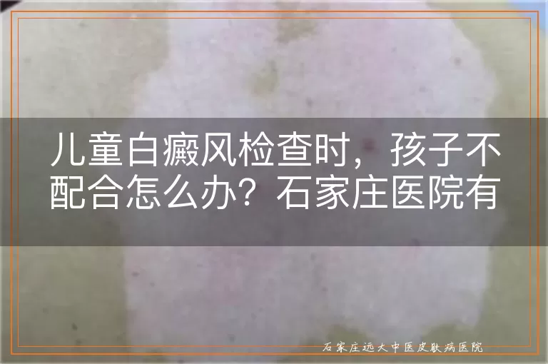 儿童白癜风检查时,孩子不配合怎么办?石家庄医院有妙招