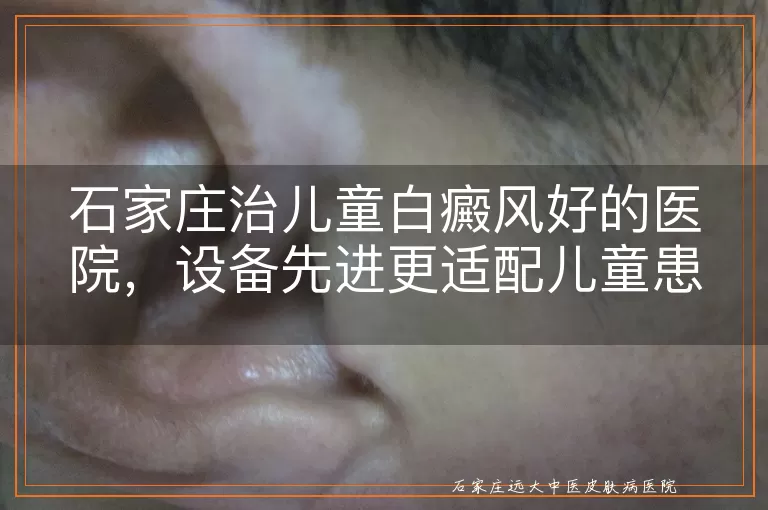 石家庄治儿童白癜风好的医院,设备先进更适配儿童患者