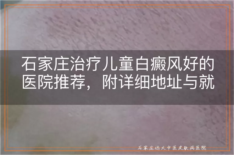 石家庄治疗儿童白癜风好的医院推荐，附详细地址与就诊时间