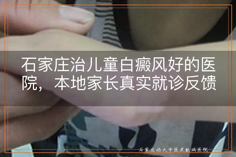 石家庄治儿童白癜风好的医院，本地家长真实就诊反馈