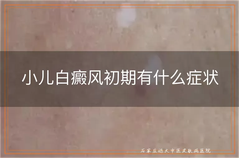 小儿白癜风初期有什么症状
