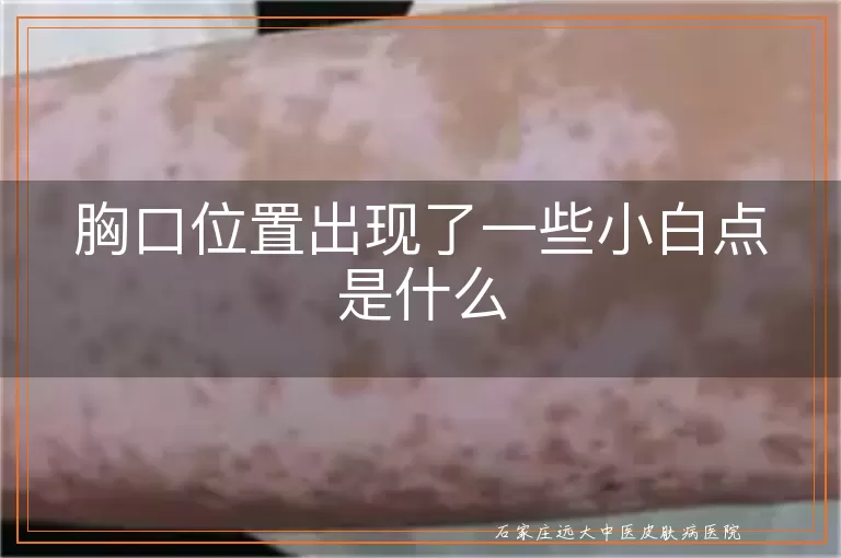胸口位置出现了一些小白点是什么