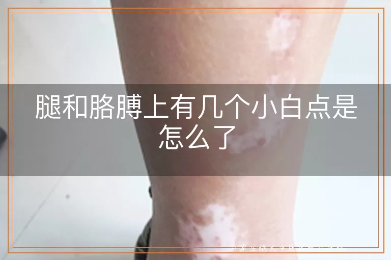 腿和胳膊上有几个小白点是怎么了