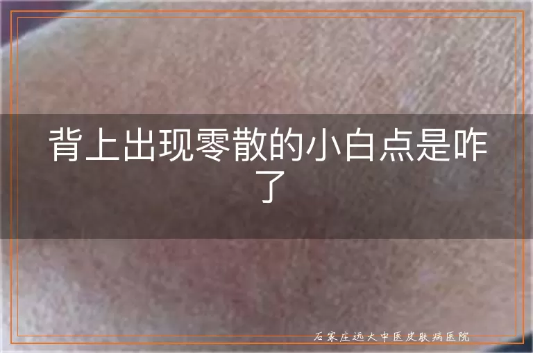 背上出现零散的小白点是咋了