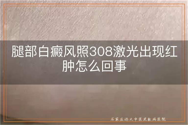 腿部白癜风照308激光出现红肿怎么回事