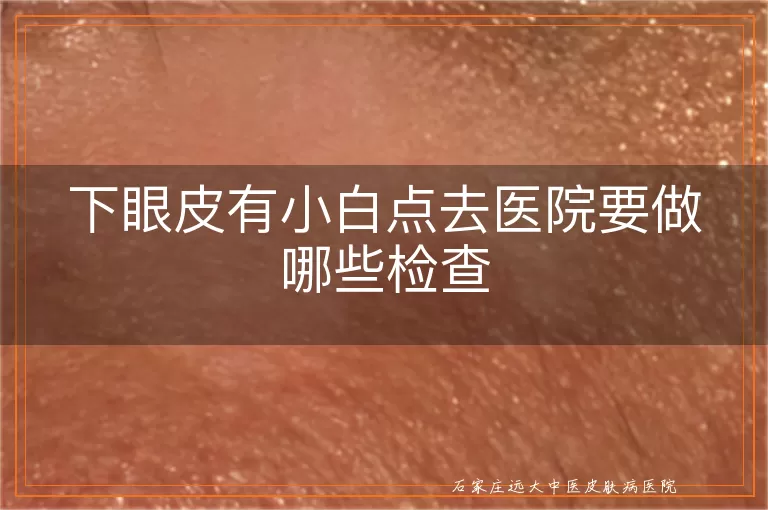 下眼皮有小白点去医院要做哪些检查