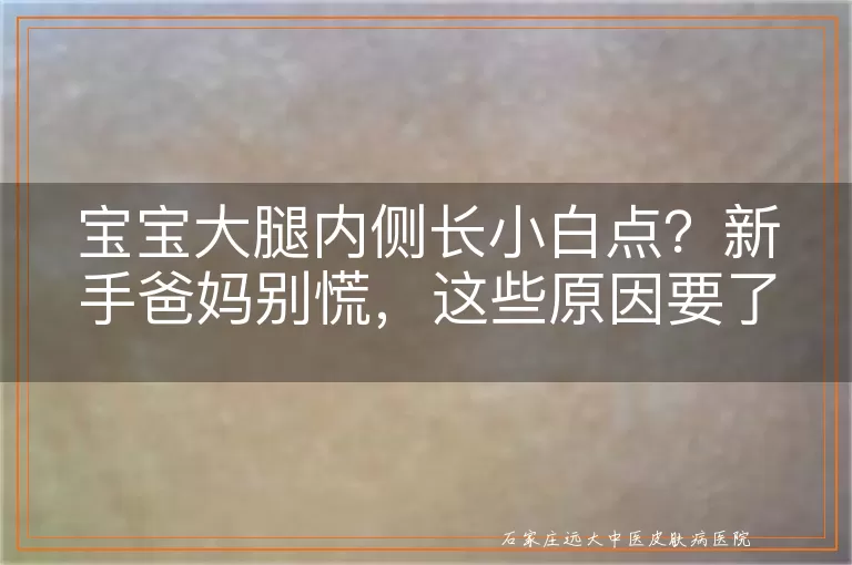 宝宝大腿内侧长小白点？新手爸妈别慌，这些原因要了解