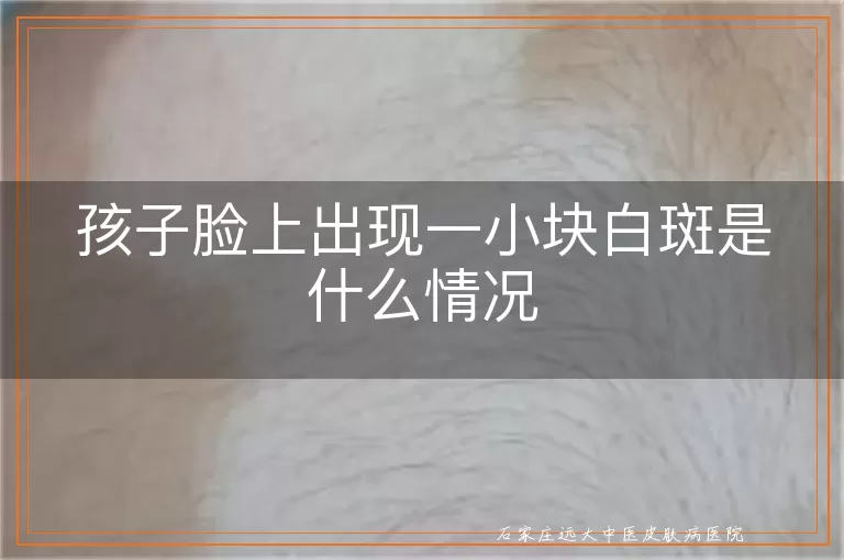 孩子脸上出现一小块白斑是什么情况