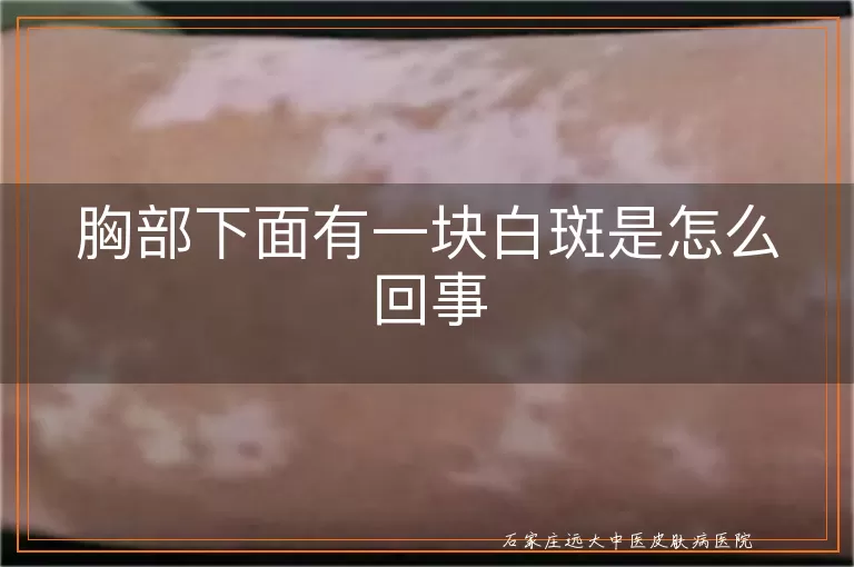 胸部下面有一块白斑是怎么回事