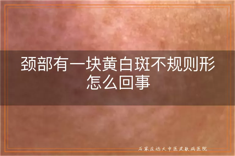 颈部有一块黄白斑不规则形怎么回事