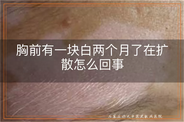 胸前有一块白两个月了在扩散怎么回事