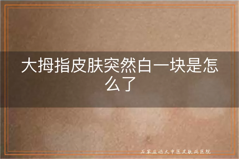大拇指皮肤突然白一块是怎么了