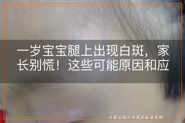 一岁宝宝腿上出现白斑，家长别慌！这些可能原因和应对方法请收好