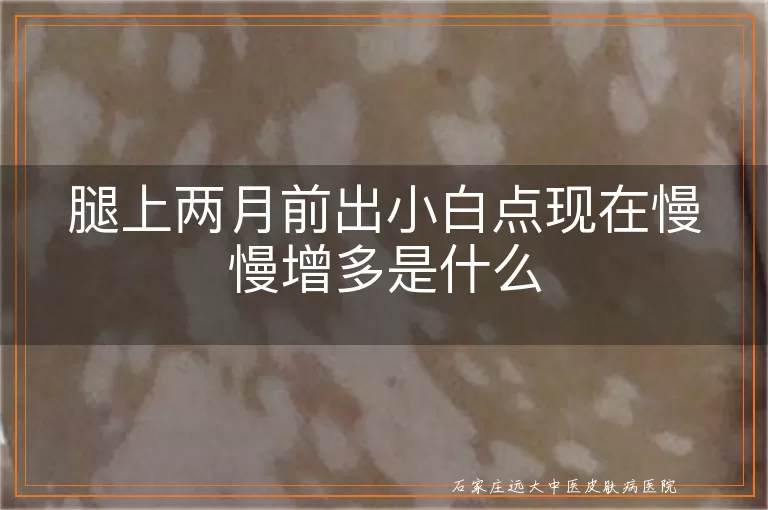 腿上两月前出小白点现在慢慢增多是什么
