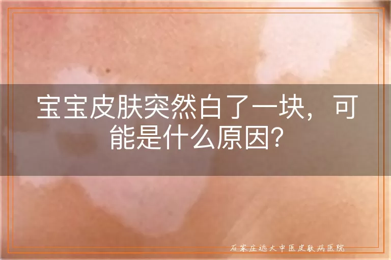 宝宝皮肤突然白了一块，可能是什么原因？
