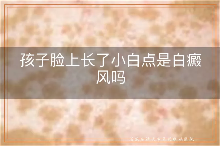 孩子脸上长了小白点是白癜风吗