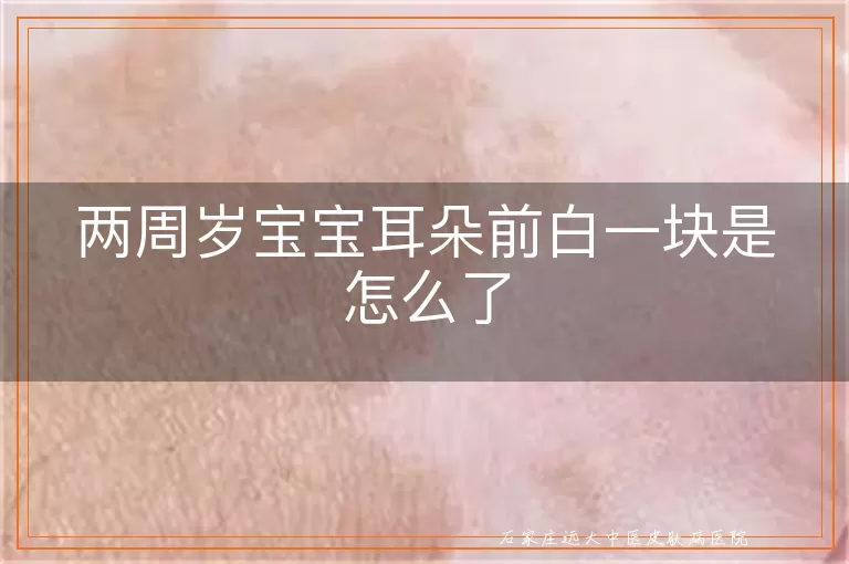 两周岁宝宝耳朵前白一块是怎么了