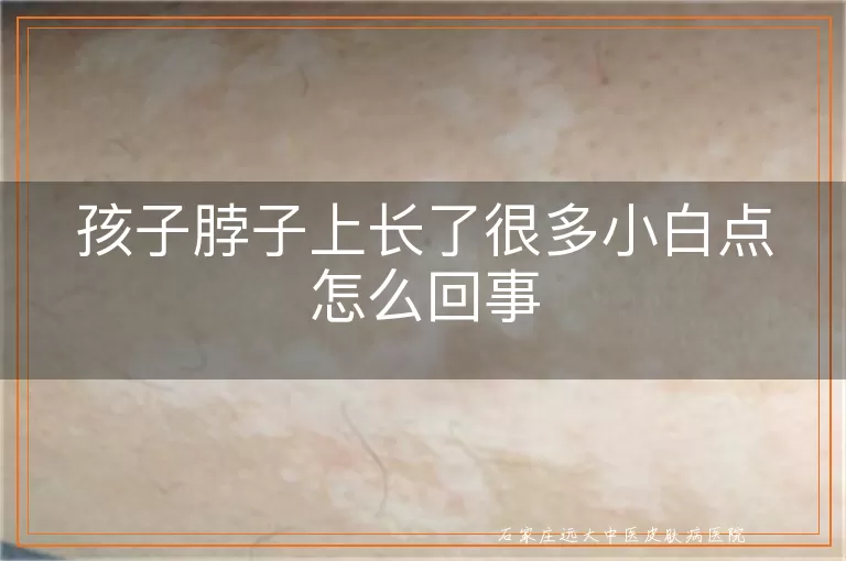 孩子脖子上长了很多小白点怎么回事