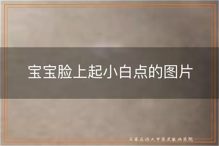 宝宝脸上起小白点的图片