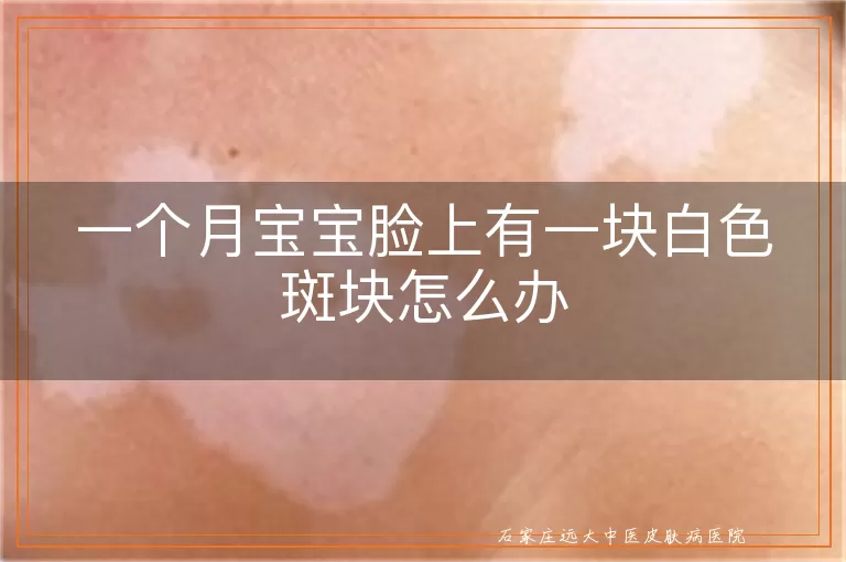 一个月宝宝脸上有一块白色斑块怎么办
