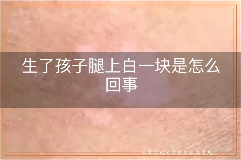生了孩子腿上白一块是怎么回事