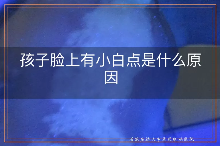 孩子脸上有小白点是什么原因
