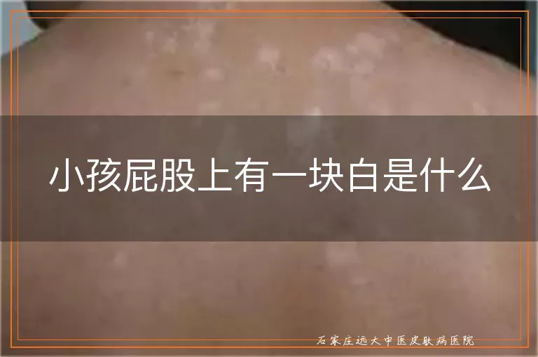 小孩屁股上有一块白是什么