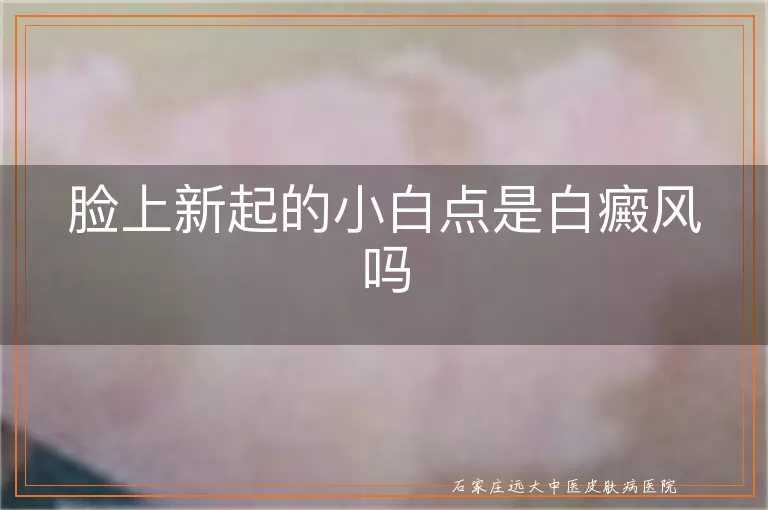脸上新起的小白点是白癜风吗