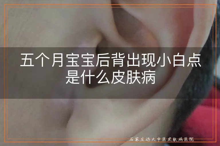 五个月宝宝后背出现小白点是什么皮肤病