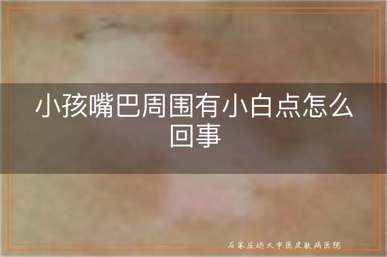 小孩嘴巴周围有小白点怎么回事