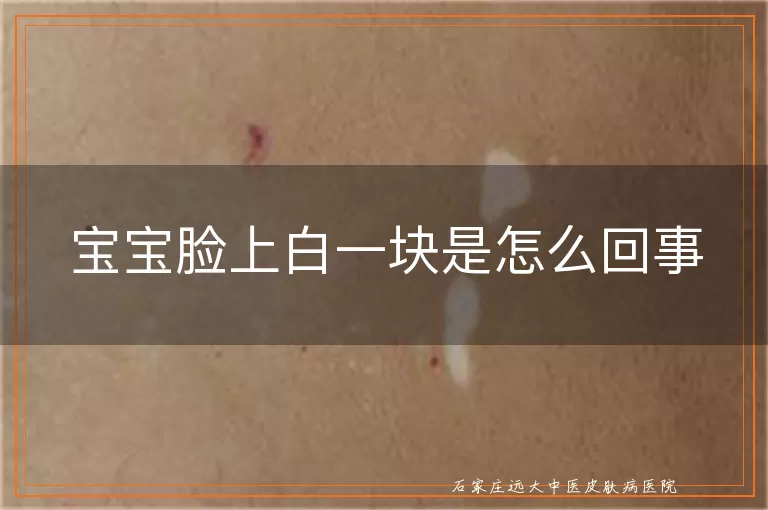 宝宝脸上白一块是怎么回事
