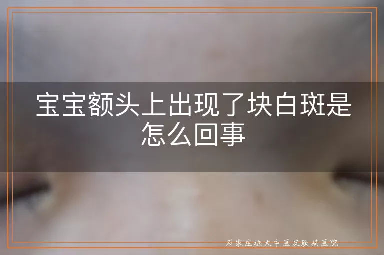 宝宝额头上出现了块白斑是怎么回事