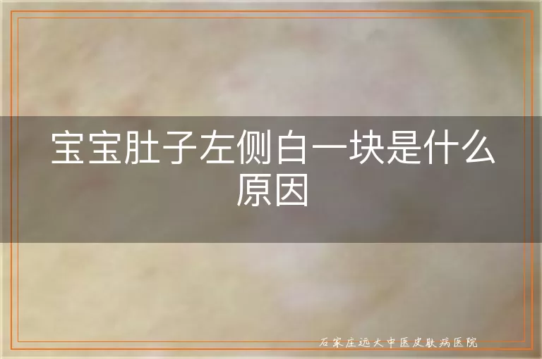 宝宝肚子左侧白一块是什么原因