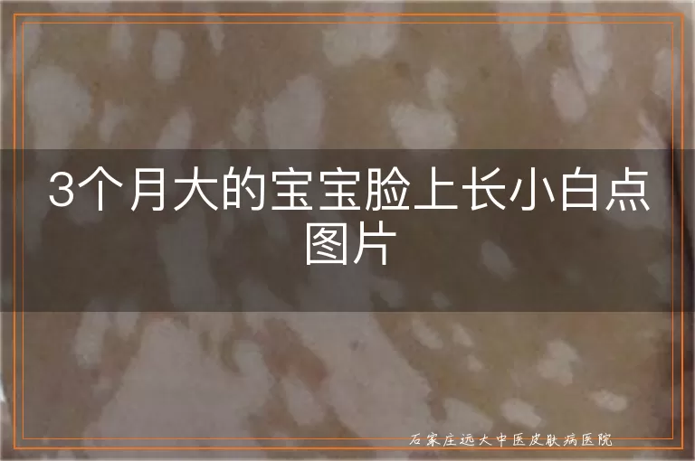 3个月大的宝宝脸上长小白点图片