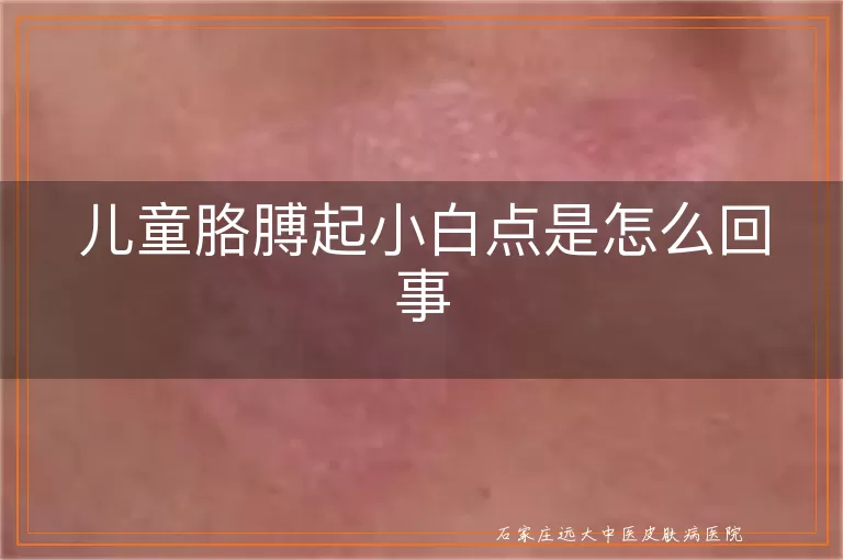 儿童胳膊起小白点是怎么回事