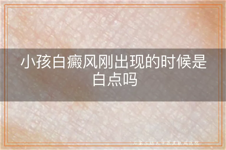 小孩白癜风刚出现的时候是白点吗