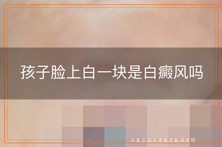 孩子脸上白一块是白癜风吗